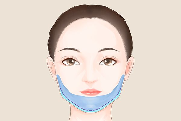 如何減掉雙下巴妙招