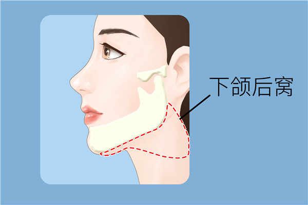 如何減掉雙下巴妙招