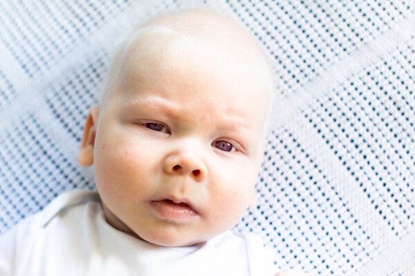 单基因遗传病有哪些病例