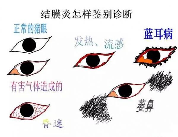 结膜炎鉴别