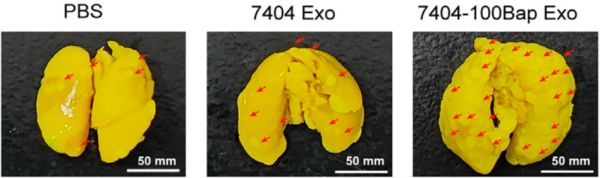 烤串越香，致癌物越高？研究发现：烧烤产生的致癌物会让癌细胞乱跑