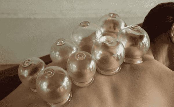 拔火罐可以治哪些疾病？拔火罐有什么注意事项？(1)