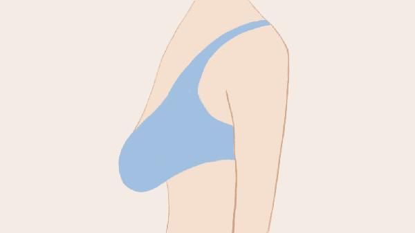 乳房下垂矫正手术恢复多久