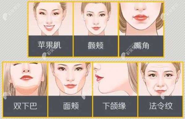 颌面部吸脂指哪个部位