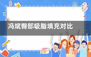 冯斌臀部吸脂填充对比照片,多点多层次立体注射填充臀部|术后臀部饱满自然|和身体整体协调