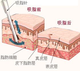 https://img.miyanlife.com/timg/160222/140IRE6-0.jpg