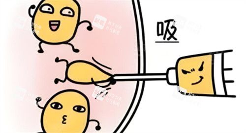 吸脂术动画