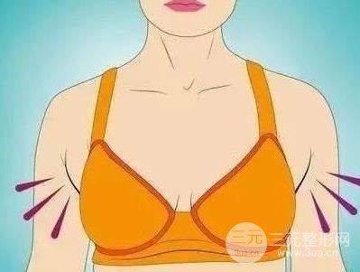 副乳吸脂前后對比圖，副乳吸脂手術(shù)過程解析~