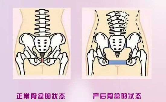 U526P946DT20170120141223.jpg
