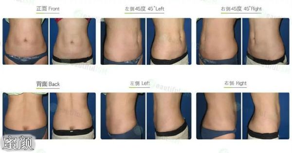 https://img.miyanlife.com/mnt/Editor/2024-02-07/65c379a520af1.jpg