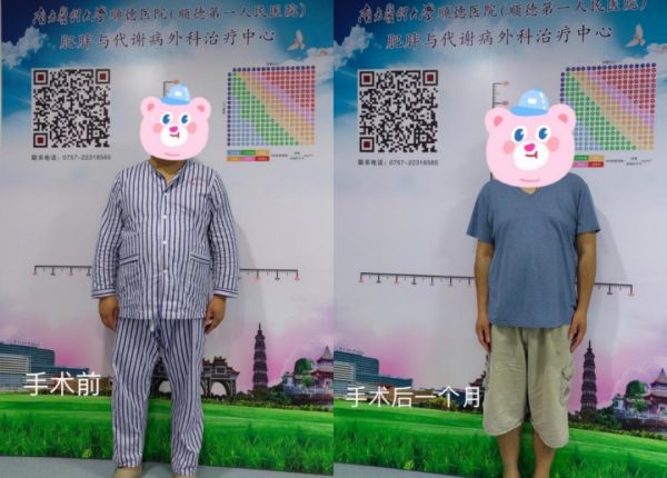 减重手术是如何让他们更健康的？