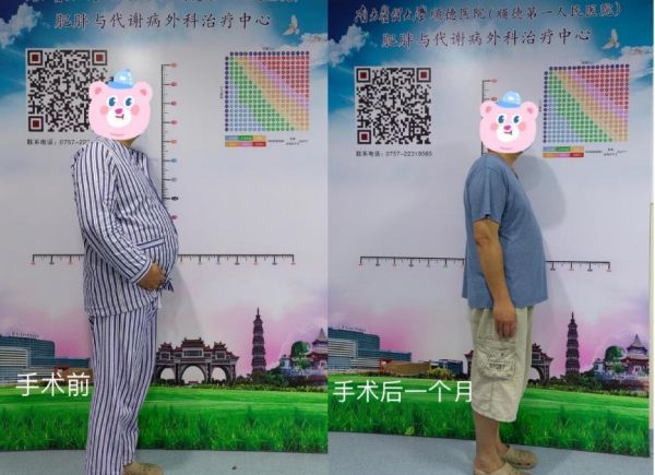 减重手术是如何让他们更健康的？