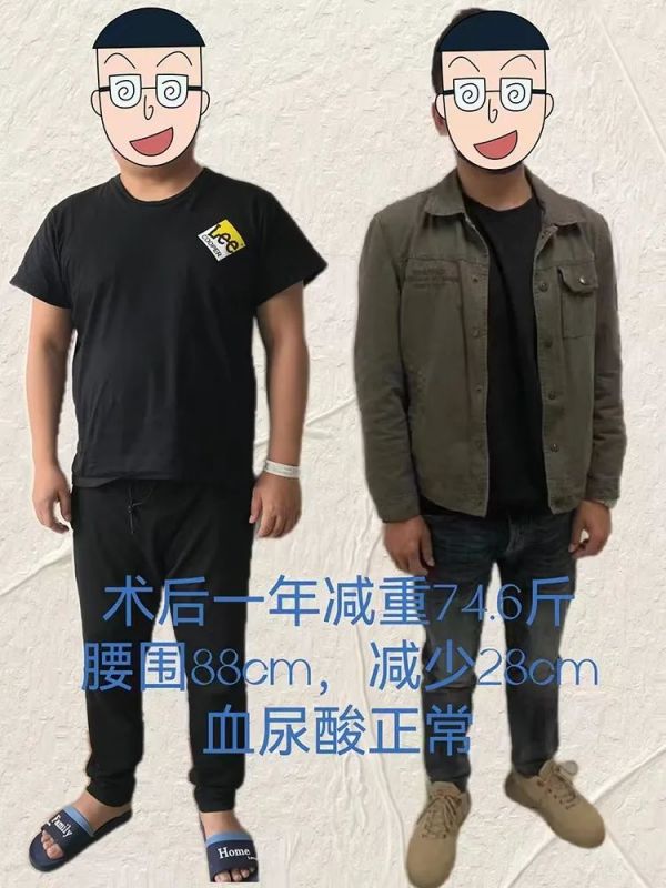 减重手术是如何让他们更健康的？