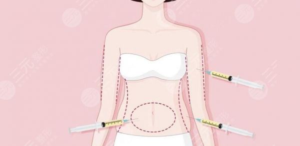 腰腹吸脂