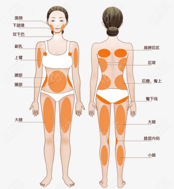全身抽脂价格表