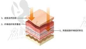 国内吸脂比较有名的医师名单整理