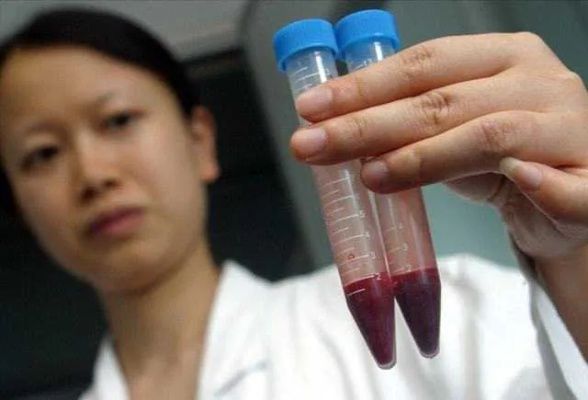 早餐后女性验血是否影响结果揭秘健康小贴士