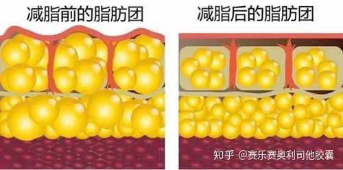 瘦全身运动做可以瘦肚子吗_做什么运动可以瘦全身_全身运动能瘦肚子吗