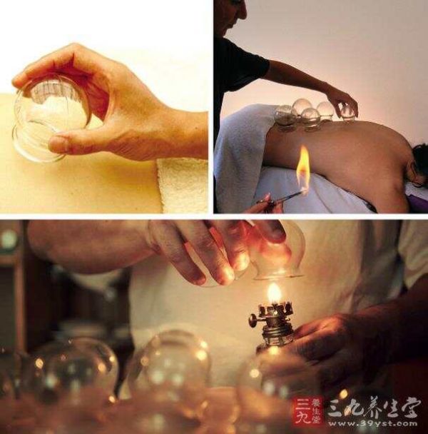 不可不知的拔火罐三误区