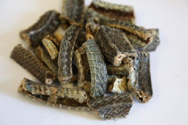 中医拔罐减肥怎么做？中医拔罐减肥要注意什么？