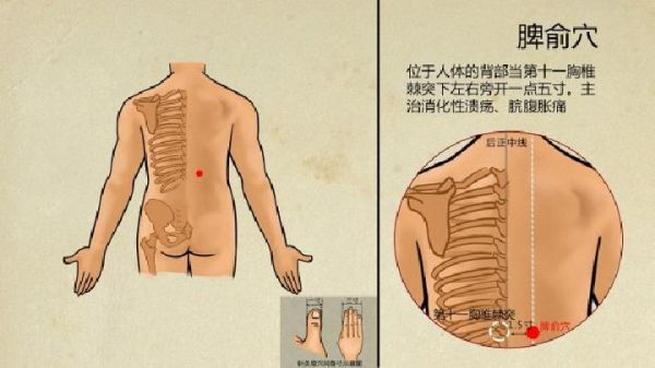 中医拔罐减肥怎么做？中医拔罐减肥要注意什么？