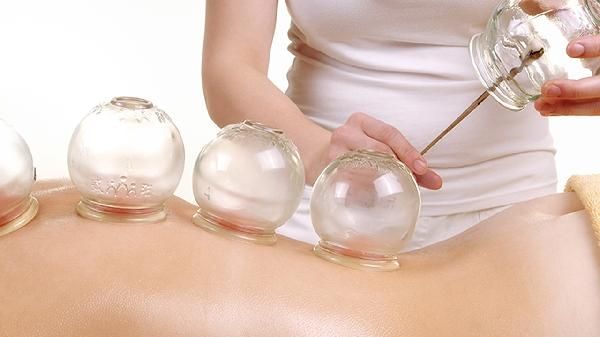 拔罐对运动员的好处