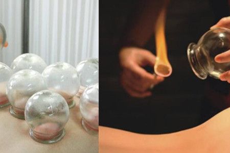 火罐減肥的副作用有哪些，這些注意事項要牢記