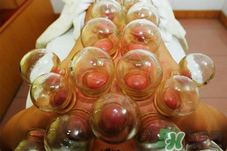 拔罐减肥为什么会反弹？拔罐减肥后不反弹的方法