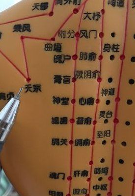 拔罐位置（拔罐位置对照表）