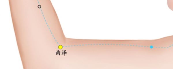 曲泽穴穴位的准确位置图 曲泽穴在哪里 曲泽穴的作用是什么