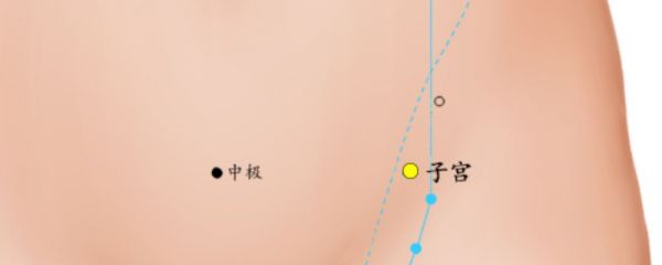 子宫穴位准确位置图 子宫穴位位置图 子宫穴位
