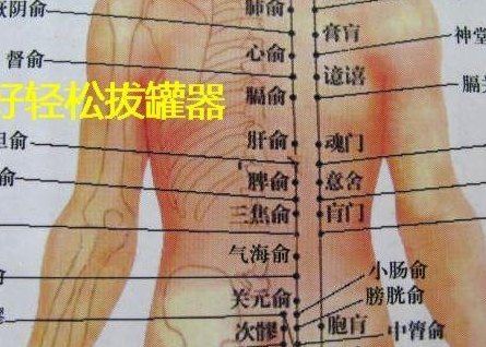 背部拔罐位置示意图（背部拔罐图解大全）
