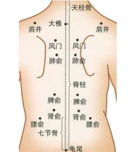 拔罐减肥拔哪个部位图