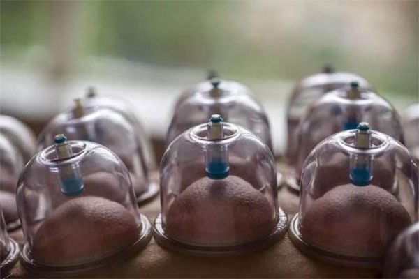 拔罐减肥拔哪些部位 拔罐减肥有科学依据吗