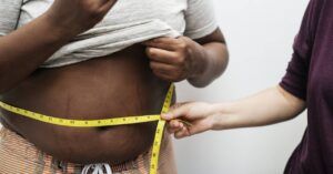 hombre con obesidad midiendose la cintura