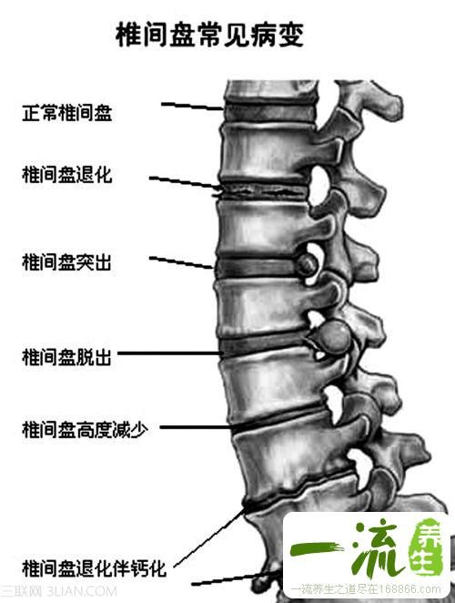 关于脊椎健康的一切