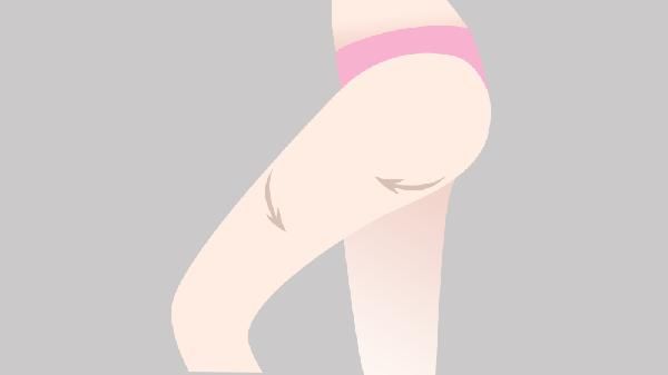 蹲马步能瘦大腿内侧
