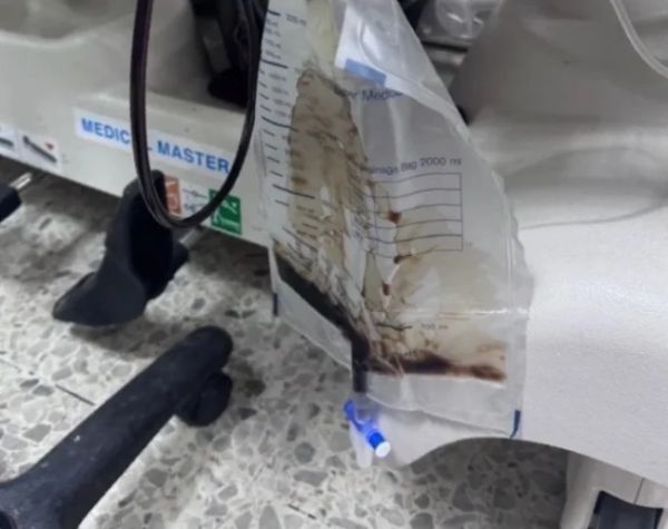 泰中学生被罚深蹲 患横纹肌溶解症