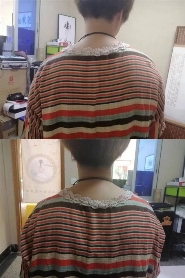 徒手整形培训 西安面部微雕培训哪里有