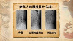 老年人的腰椎什么样图片