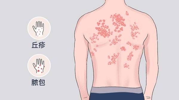 解锁土大黄治疗皮肤病的正确方式！