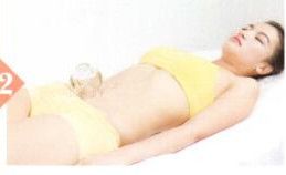 子宫脱垂拔罐部位图解