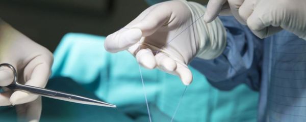 子宫内膜息肉手术后要休息几天 子宫内膜息肉的治疗 子宫内膜息肉的症状