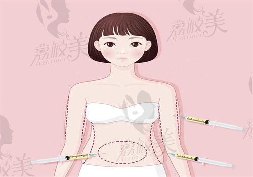 昆明吴氏嘉美吸脂价格表