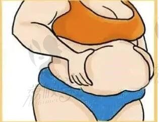 昆明吴氏嘉美吸脂怎么样