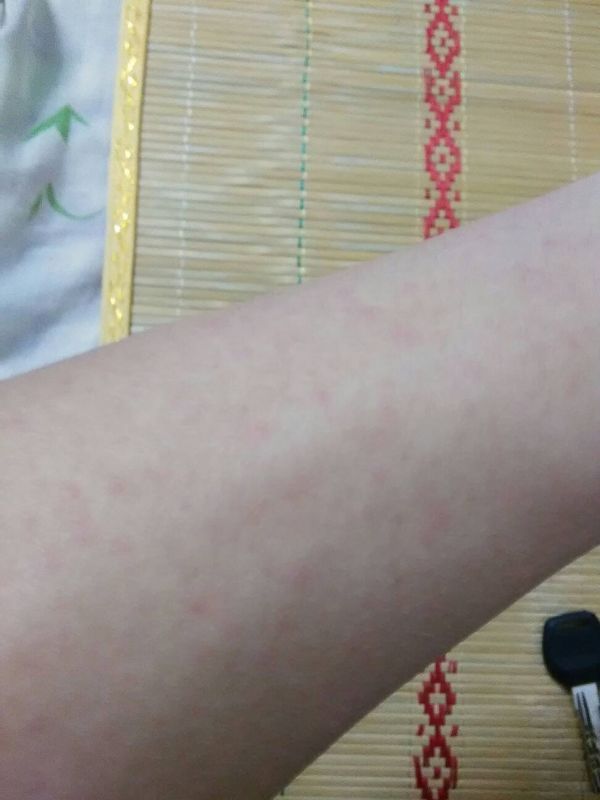 献血检测hiv核酸么