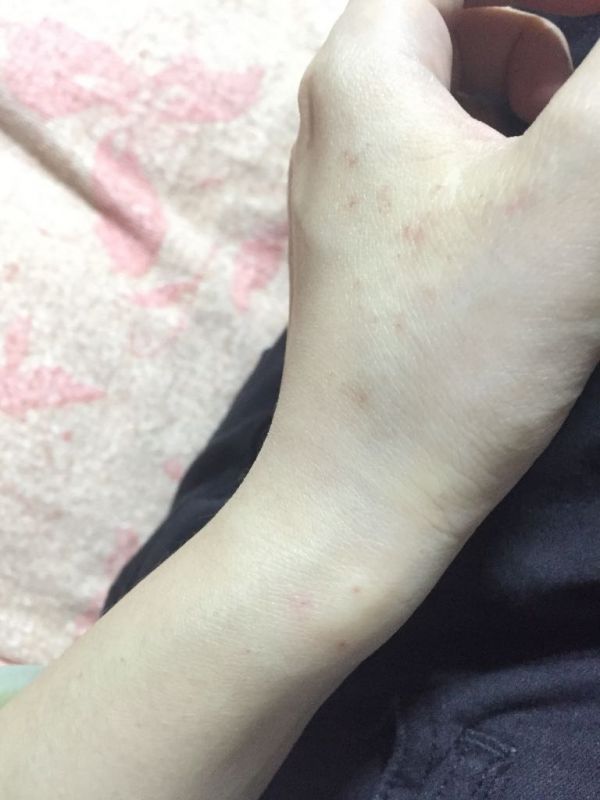 淄博中心血站HIV核酸检测