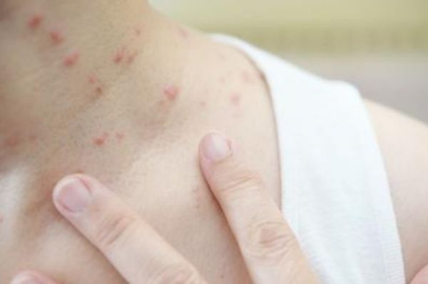 hiv核酸检测是输血还是抽血