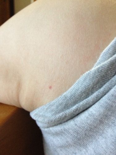 核酸检测为什么不能排除hiv好大夫