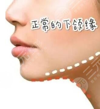 什么因素會影響下頜線的美感